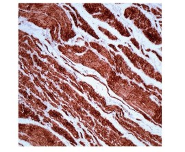 Actina Do Músculo Liso (SMA), Clone 1a4 Pronto Para Uso - 6 Ml - Easypath - EP-12-52836